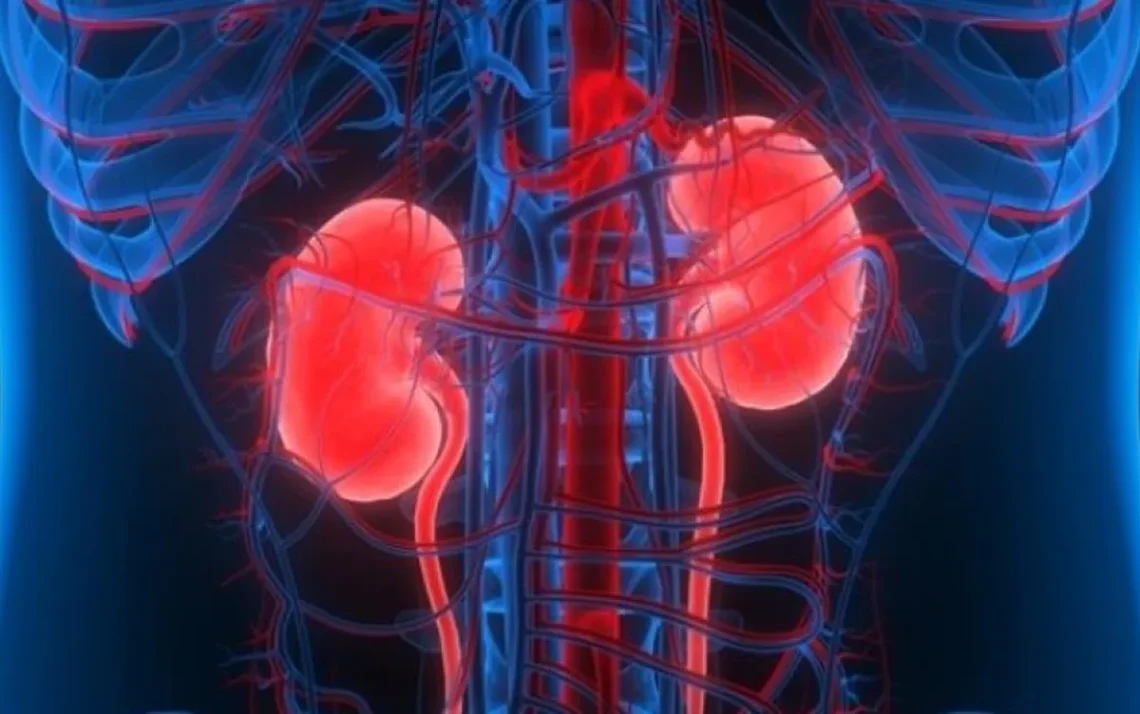 diálise, terapia de substituição renal